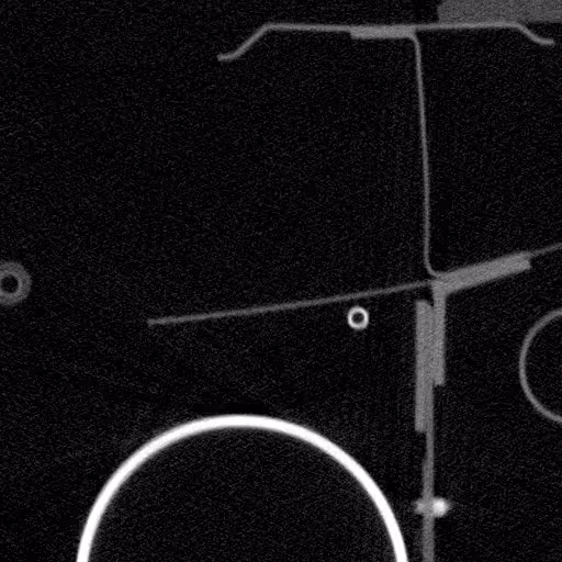 Axial slice 384 of the volume