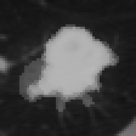 A 46 mm square of the chest CT around the nodule. A grey veil is lightest where all four readers included the pixel and darkest where only one did. Four white outlines follow the readers' published edges; they agree on most of the edge and spread apart at the lower left and lower right.