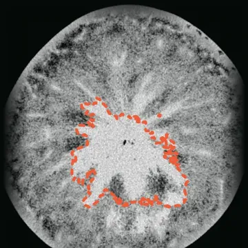 A CT slice of an apple with a browned core, and a model's proposal dashed around the core.