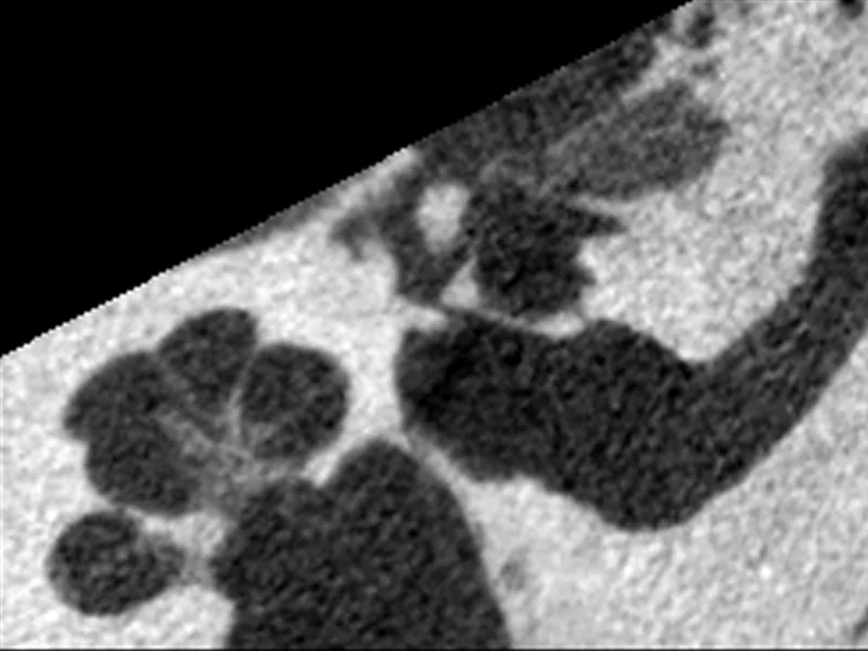 A real micro-CT slice of a human temporal bone with the bony labyrinth outlined in white and four anatomical landmarks marked with crosses.