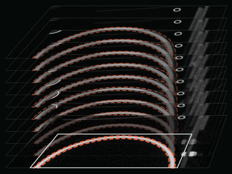 Ten slices of a real industrial CT scan stacked in a fixed tilted view; a box on the front slice, and SAM 2.1's dashed proposal round the bottle wall appearing on each slice behind it.