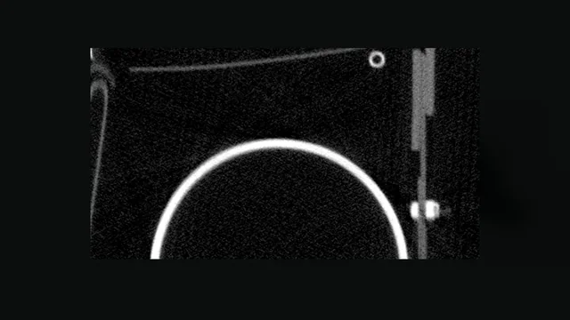 One CT slice with the bright round wall of the pressure bottle.