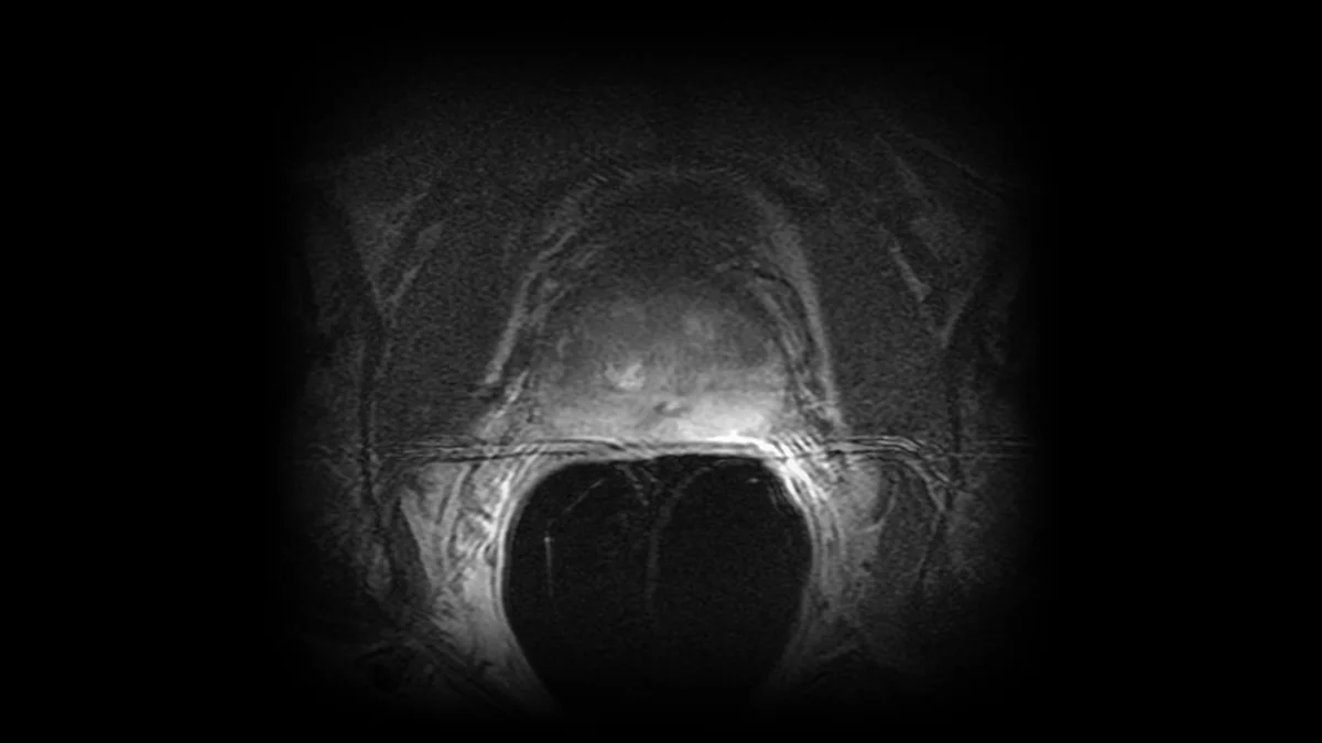 A real MRI slice of the pelvis from a public research collection.